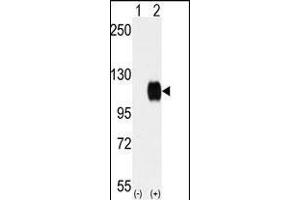 Western blot analysis of SKY (arrow) using rabbit polyclonal SKY Antibody (C-term) (ABIN392054 and ABIN2841821). (TYRO3 抗体  (C-Term))