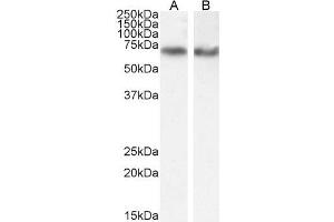 Western Blotting (WB) image for anti-EH-Domain Containing 2 (EHD2) (C-Term) antibody (ABIN185287)