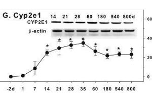 Western Blotting (WB) image for anti-Cytochrome P450, Family 2, Subfamily E, Polypeptide 1 (CYP2E1) (AA 401-493) antibody (ABIN707141)