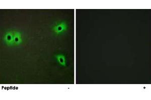 Immunofluorescence analysis of A-549 cells, using COL13A1 polyclonal antibody . (COL13A1 抗体)