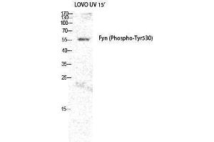 Western Blotting (WB) image for anti-FYN Oncogene Related To SRC, FGR, YES (FYN) (pTyr530) antibody (ABIN3179641) (FYN 抗体  (pTyr530))