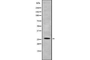 Western blot analysis IL-32 using K562 whole cell lysates (IL32 抗体)