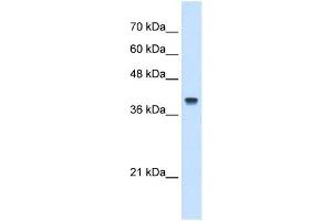 IFI44L antibody used at 5 ug/ml to detect target protein. (IFI44L 抗体  (N-Term))