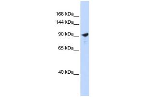 WB Suggested Anti-PAPPA2 Antibody Titration:  0. (PAPPA2 抗体  (Middle Region))
