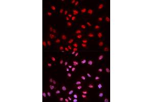 Immunofluorescence analysis of MCF-7 cells using Phospho-ELK1-S383 antibody (ABIN5969890). (ELK1 抗体  (pSer383))