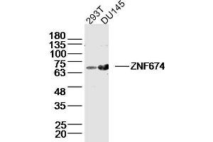 Lane 1: 293T lysates Lane 2: DU145 lysates probed with ZNF674 Polyclonal Antibody, Unconjugated  at 1:300 dilution and 4˚C overnight incubation. (ZNF674 抗体  (AA 301-400))