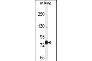 EXOC8 Antibody (Center) (ABIN654161 and ABIN2844025) western blot analysis in mouse lung tissue lysates (35 μg/lane). (EXOC8 抗体  (AA 360-389))