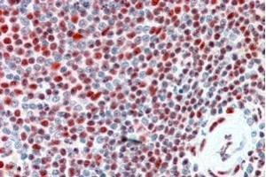 Immunohistochemistry (IHC) image for anti-Interleukin Enhancer Binding Factor 2, 45kDa (ILF2) (Internal Region) antibody (ABIN190786)