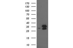 Western Blotting (WB) image for anti-Eukaryotic Translation Initiation Factor 4E Family Member 2 (EIF4E2) antibody (ABIN1497992) (EIF4E2 抗体)