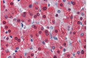 Human Liver (formalin-fixed, paraffin-embedded) stained with LASS2 antibody ABIN462181 followed by biotinylated goat anti-rabbit IgG secondary antibody ABIN481713, alkaline phosphatase-streptavidin and chromogen. (Ceramide Synthase 2 抗体  (AA 72-121))