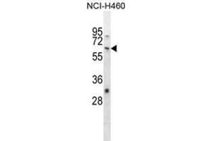 WHSC2 Antibody (Center) western blot analysis in NCI-H460 cell line lysates (35 µg/lane). (WHSC2 抗体  (Middle Region))