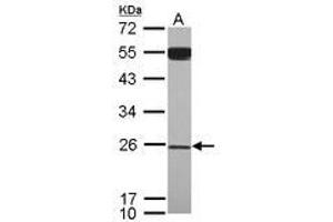 Image no. 1 for anti-YEATS Domain Containing 4 (AA 1-203) antibody (ABIN1501789) (GAS41 抗体  (AA 1-203))