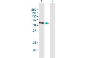 Western Blot analysis of VEGFC expression in transfected 293T cell line by VEGFC MaxPab polyclonal antibody. (VEGFC 抗体  (AA 1-419))
