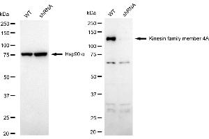Western blotting analysis using kinesin family member 4A antibody (ABIN7799207). (Recombinant KIF4A 抗体)