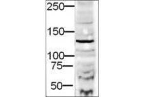 Image no. 1 for anti-Diaphanous Homolog 2 (DIAPH2) (AA 1085-1101) antibody (ABIN199948) (DIAPH2 抗体  (AA 1085-1101))