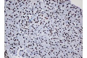 Image no. 6 for anti-Decapping Enzyme, Scavenger (DCPS) antibody (ABIN1497780) (DCPS 抗体)