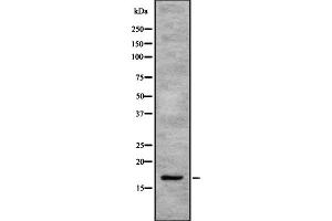 Western blot analysis SEP15 using K562 whole cell lysates. (Selenoprotein F 抗体)