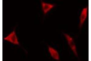 ABIN6267620 staining HeLa cells by IF/ICC. (Caldesmon 抗体  (pSer789))