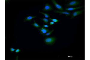 Immunofluorescence of purified MaxPab antibody to HOMER2 on HeLa cell. (HOMER2 抗体  (AA 1-343))