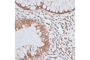 Immunohistochemistry (IHC) image for anti-Kinesin Family Member C1 (KIFC1) (AA 1-250) antibody (ABIN1680592)