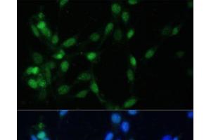 Immunofluorescence analysis of NIH-3T3 cells using MAD2L1 Polyclonal Antibody at dilution of 1:100 (40x lens). (MAD2L1 抗体)