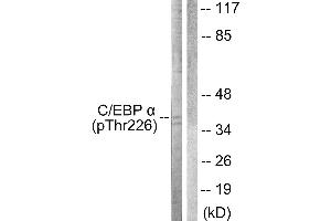 Western blot analysis of extracts from COS7 cells, treated with EGF (200ng/ml, 30mins), using C/EBP-α (Phospho-Thr226) antibody. (CEBPA 抗体  (pThr226))