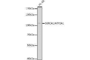 Western blot analysis of extracts of HL-60 cells, using SERC/SERC/ antibody (0104) at 1:1000 dilution. (ATP2A1/SERCA1 抗体  (AA 350-600))
