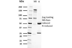 SDS-PAGE Analysis Purified RET Mouse Monoclonal Antibody (RET/2662). (Ret Proto-Oncogene 抗体  (AA 702-848))