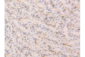 Detection of FABP4 in Mouse Kidney Tissue using Polyclonal Antibody to Fatty Acid Binding Protein 4 (FABP4) (FABP4 抗体  (AA 2-132))
