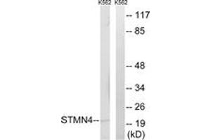 Western blot analysis of extracts from K562 cells, using STMN4 Antibody. (STMN4 抗体  (AA 140-189))