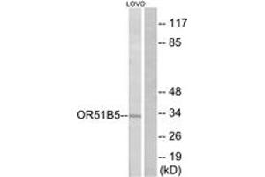 Western blot analysis of extracts from LOVO cells, using OR51B5 Antibody. (OR51B5 抗体  (AA 200-249))