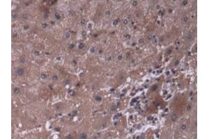 DAB staining on IHC-P; Samples: Human Liver Tissue (P4HA3 抗体  (AA 227-544))