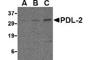 Western Blotting (WB) image for anti-Programmed Cell Death 1 Ligand 2 (PDCD1LG2) (Middle Region) antibody (ABIN1031035) (PDCD1LG2 抗体  (Middle Region))