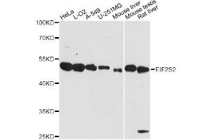 Western blot analysis of extracts of various cell lines, using EIF2S2 antibody. (EIF2S2 抗体)