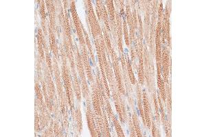 Immunohistochemistry (IHC) image for anti-G Protein-Coupled Receptor Kinase 5 (GRK5) (AA 371-590) antibody (ABIN1680115)