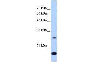 WB Suggested Anti-USE1 Antibody Titration:  2. (UBE2Z 抗体  (Middle Region))