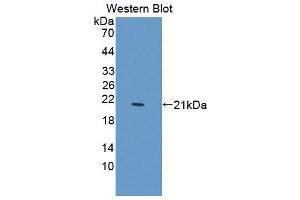 Western blot analysis of the recombinant protein. (PTPN13 抗体  (AA 1-161))