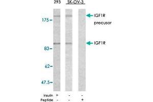 Western blot analysis of extracts from 293 and SK-OV-3 cells using IGF1R polyclonal antibody  . (IGF1R 抗体)