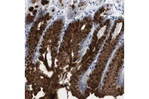 Immunohistochemical staining of human stomach with C1RL polyclonal antibody  shows strong cytoplasmic positivity in glandular cells. (C1RL 抗体)