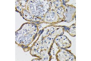 Immunohistochemistry (IHC) image for anti-IQ Motif Containing GTPase Activating Protein 1 (IQGAP1) (AA 500-750) antibody (ABIN7268020)