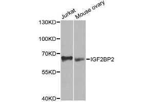 Western blot analysis of extracts of various cell lines, using IGF2BP2 antibody. (IGF2BP2 抗体  (C-Term))
