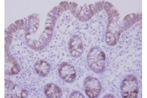 IHC-P Image Immunohistochemical analysis of paraffin-embedded human normal colon, using CCDC83, antibody at 1:500 dilution. (CCDC83 抗体)