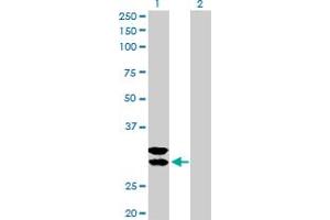 Western Blot analysis of TPSAB1 expression in transfected 293T cell line by TPSAB1 MaxPab polyclonal antibody. (TPSAB1 抗体  (AA 1-275))