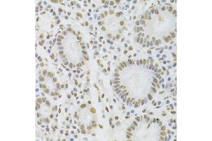 Immunohistochemistry of paraffin-embedded human stomach using HNRNPD Antibody. (HNRNPD/AUF1 抗体  (AA 1-306))