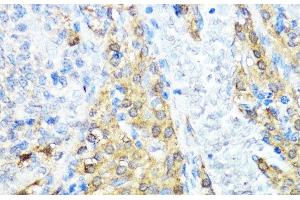 Immunohistochemistry of paraffin-embedded Rat ovary using NOD1 Polyclonal Antibody at dilution of 1:100 (40x lens). (NOD1 抗体)
