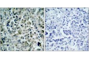 Immunohistochemistry (IHC) image for anti-Histone Deacetylase 8 (HDAC8) (AA 5-54) antibody (ABIN2888999) (HDAC8 抗体  (AA 5-54))