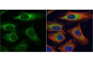 ICC/IF Image alpha Dystroglycan antibody detects alpha Dystroglycan protein at cytoplasm by immunofluorescent analysis. (Dystroglycan 抗体)