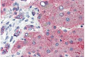 Human Liver (formalin-fixed, paraffin-embedded) stained with CLDN1 antibody ABIN457476 at 5 ug/ml followed by biotinylated goat anti-rabbit IgG secondary antibody ABIN481713, alkaline phosphatase-streptavidin and chromogen. (Claudin 1 抗体  (C-Term))