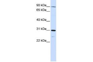 WB Suggested Anti-LONRF3 Antibody Titration:  0. (LONRF3 抗体  (N-Term))