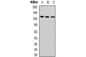 Western blot analysis of SUPT16H expression in Hela (A), A549 (B), Jurkat (C) whole cell lysates. (SUPT16H 抗体  (C-Term))